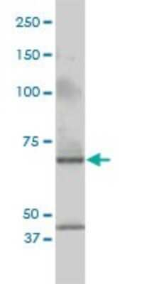 Western Blot: Cleavage stimulation factor 2 Antibody (3D1-3A6) [H00001478-M01]