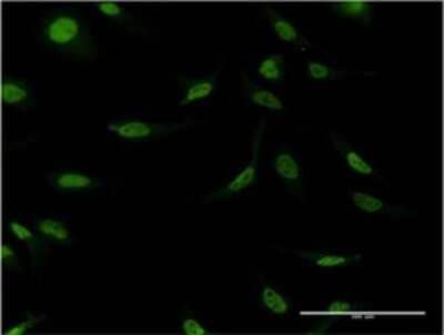 Immunocytochemistry/ Immunofluorescence: Cleavage stimulation factor 2 Antibody (4E3-3C9) [H00001478-M02]