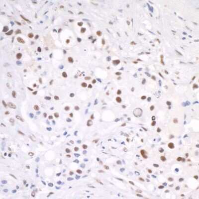 Immunohistochemistry: Cleavage stimulation factor 2 Antibody [NB100-57530]