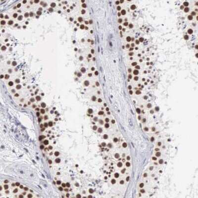 Immunohistochemistry-Paraffin: Cleavage stimulation factor 2 Antibody [NBP1-87407]
