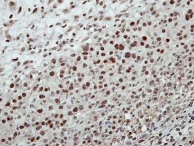 Immunohistochemistry-Paraffin: Cleavage stimulation factor 2 Antibody [NBP2-15915]