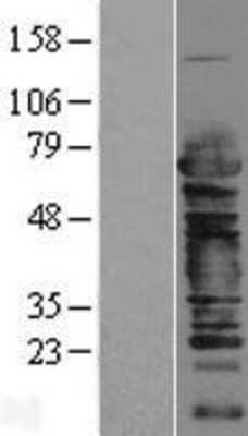 Western Blot: Cleavage stimulation factor 2 Overexpression Lysate [NBP2-04195]