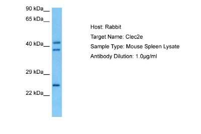 Western Blot: Clec2e Antibody [NBP3-10220]