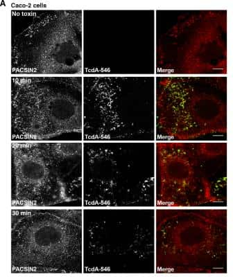 Immunocytochemistry/ Immunofluorescence: Clostridium Difficile Toxin A Antibody (PCG4.1) - BSA Free [NB600-1066]