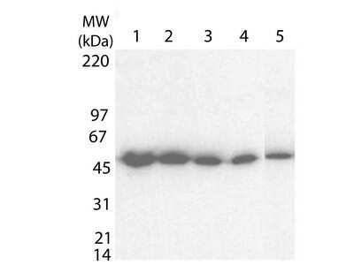 Western Blot: Clostridium Tetani Toxoid Antibody [NBP1-78003]