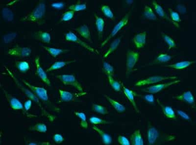 Immunocytochemistry/ Immunofluorescence: Clusterin/APOJ Antibody (13) [NBP2-89884]