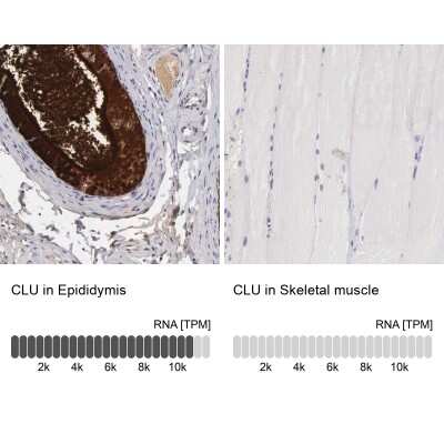 Immunohistochemistry-Paraffin: Clusterin/APOJ Antibody [NBP1-90128]