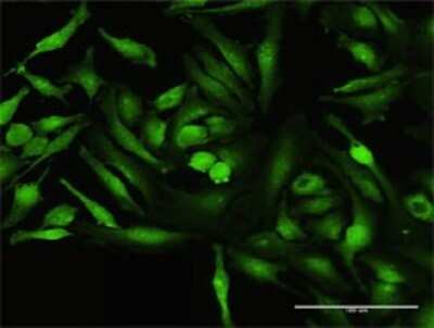 Immunocytochemistry/ Immunofluorescence: CoCoA Antibody [H00057658-B01P]