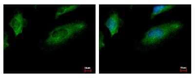 Immunocytochemistry/ Immunofluorescence: CoCoA Antibody [NBP1-32154]