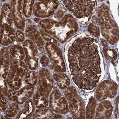 Immunohistochemistry-Paraffin: CoCoA Antibody [NBP1-88216]