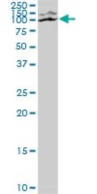 Western Blot: CoCoA Antibody [H00057658-B01P]