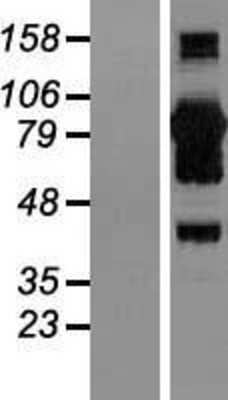 Western Blot: CoCoA Overexpression Lysate [NBL1-08645]