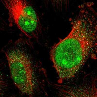 Immunocytochemistry/ Immunofluorescence: CoREST3/RCOR3 Antibody [NBP1-83820]