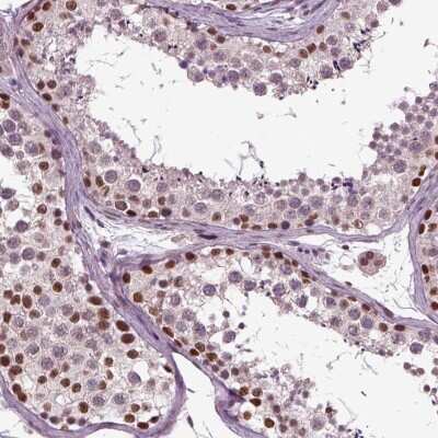 Immunohistochemistry: CoREST3/RCOR3 Antibody [NBP2-68930]