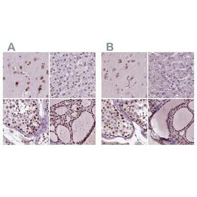 Immunohistochemistry-Paraffin: CoREST3/RCOR3 Antibody [NBP1-83820]