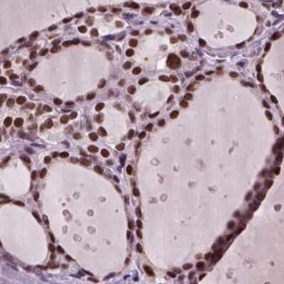 Immunohistochemistry-Paraffin: CoREST3/RCOR3 Antibody [NBP1-83820]