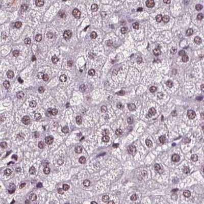 Immunohistochemistry-Paraffin: CoREST3/RCOR3 Antibody [NBP1-83820]