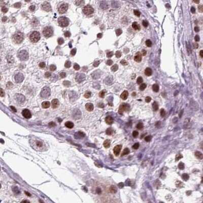 Immunohistochemistry-Paraffin: CoREST3/RCOR3 Antibody [NBP1-83820]