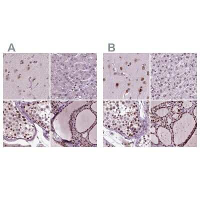 Immunohistochemistry-Paraffin: CoREST3/RCOR3 Antibody [NBP2-68930]
