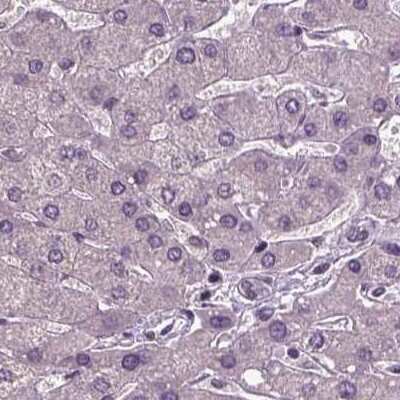 Immunohistochemistry-Paraffin: CoREST3/RCOR3 Antibody [NBP2-68930]