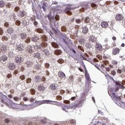 Immunohistochemistry-Paraffin: CoREST3/RCOR3 Antibody [NBP2-68930]