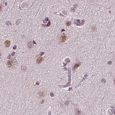 Immunohistochemistry-Paraffin: CoREST3/RCOR3 Antibody [NBP2-68930]