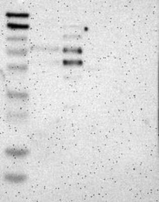 Western Blot: CoREST3/RCOR3 Antibody [NBP3-17822]