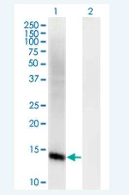 Western Blot: Coactosin-like Protein 1/CotL1 Antibody (1A2) [H00023406-M01-100ug]