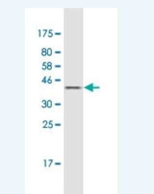 Western Blot: Coactosin-like Protein 1/CotL1 Antibody (1A2) [H00023406-M01-100ug]