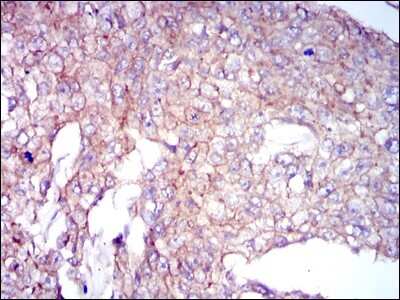 Immunohistochemistry: Coactosin-like Protein 1/CotL1 Antibody (5C8) - BSA Free [NBP2-37519]