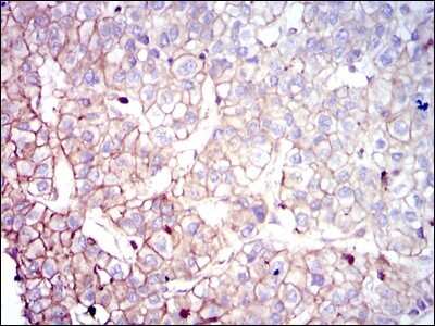 Immunohistochemistry: Coactosin-like Protein 1/CotL1 Antibody (5C8) - BSA Free [NBP2-37519]
