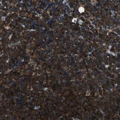 Immunohistochemistry-Paraffin: Coactosin-like Protein 1/CotL1 Antibody [NBP2-48515]