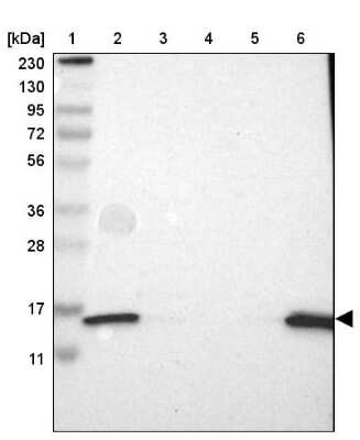 Western Blot: Coactosin-like Protein 1/CotL1 Antibody [NBP2-48515]