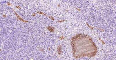 Immunohistochemistry: Thrombin-antithrombin (TAT) complexes Antibody (22) - BSA Free [NBP2-41381]