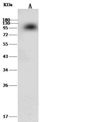 Western Blot: Coagulation Factor II/Thrombin Antibody (318) [NBP2-90543]