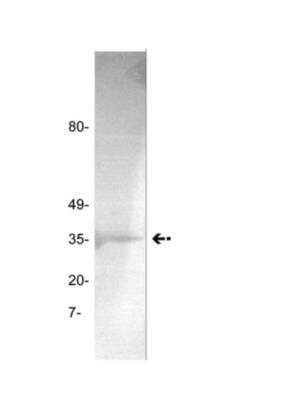 Western Blot: Coagulation Factor II/Thrombin Antibody (GMA-020) [NBP2-29813]