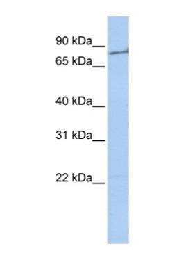 Western Blot: Prothrombin Antibody [NBP1-58268]