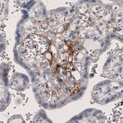 Immunohistochemistry: Coagulation Factor III/Tissue Factor Antibody (CL3805) [NBP2-61640]