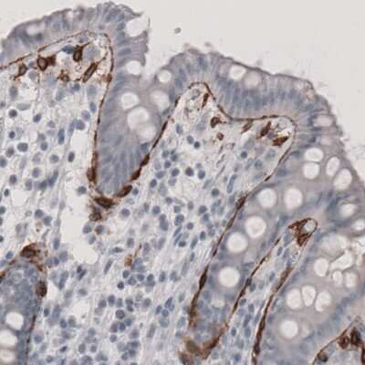 Immunohistochemistry: Coagulation Factor III/Tissue Factor Antibody (CL3805) [NBP2-61640]