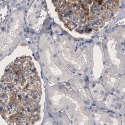 Immunohistochemistry: Coagulation Factor III/Tissue Factor Antibody (CL3805) [NBP2-61640]