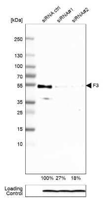 Western Blot: Coagulation Factor III/Tissue Factor Antibody (CL3805) [NBP2-61640]