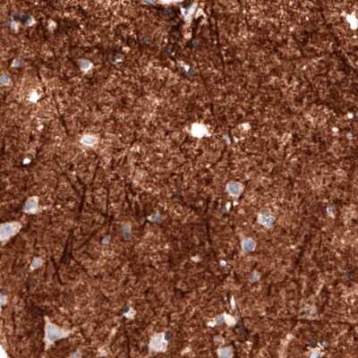 Immunohistochemistry: Coagulation Factor III/Tissue Factor Antibody (CL3807) [NBP2-61641]