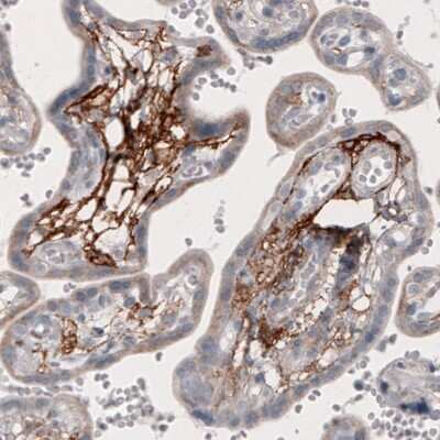 Immunohistochemistry: Coagulation Factor III/Tissue Factor Antibody (CL3807) [NBP2-61641]