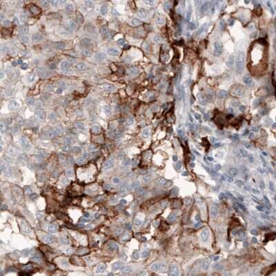 Immunohistochemistry-Paraffin: Coagulation Factor III/Tissue Factor Antibody (CL3807) [NBP2-61641]