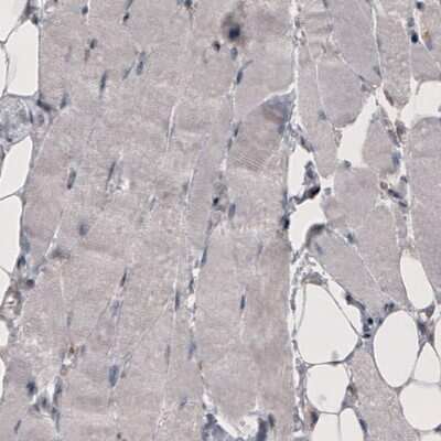Immunohistochemistry-Paraffin: Coagulation Factor III/Tissue Factor Antibody (CL3807) [NBP2-61641]