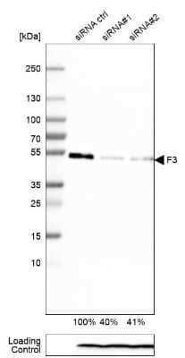 Western Blot: Coagulation Factor III/Tissue Factor Antibody (CL3807) [NBP2-61641]