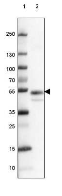 Western Blot: Coagulation Factor III/Tissue Factor Antibody (CL3807) [NBP2-61641]
