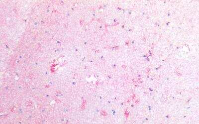 Immunohistochemistry-Paraffin: Coagulation Factor III/Tissue Factor Antibody (HTF-1) [NBP2-62199]