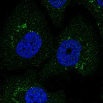 Immunocytochemistry/ Immunofluorescence: Coagulation Factor III/Tissue Factor Antibody [NBP2-55950]