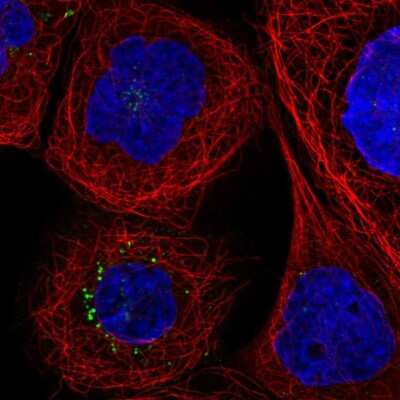 Immunocytochemistry/ Immunofluorescence: Coagulation Factor III/Tissue Factor Antibody [NBP2-58054]